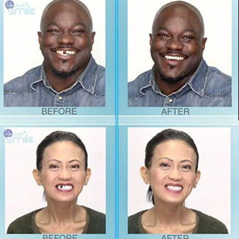 Instant Smile MULTISHADE – Patented Temporary Tooth Repair Kit with 3 Shades & 30 Customizable Teeth