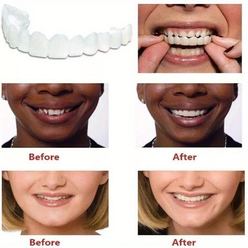 Set False Teeth Dental Snap On Upper & Bottom Veneers Dentures Fake Tooth Cover